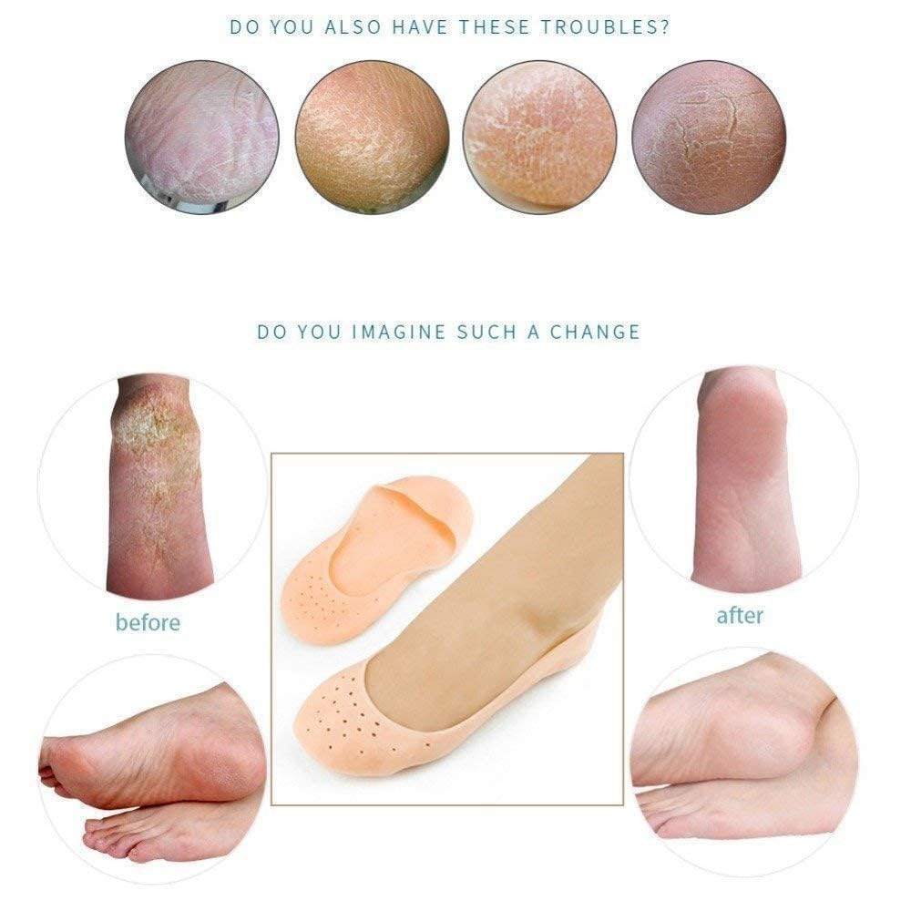 Sovely Anti Crack Silicone Gel Foot Protector Moisturizing Socks for Foot-Care and Heel Cracks Socks for Cracked Feet Heel Pad For Feet, Silicon Heel Pad For Women Pain Relief, Crack Heel Repair Socks Full Length Silicone Gel Foot Protector 1 Pair
