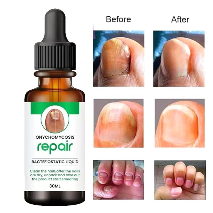 Nail Serum For Complete Nail Protection ( pack of 2 )