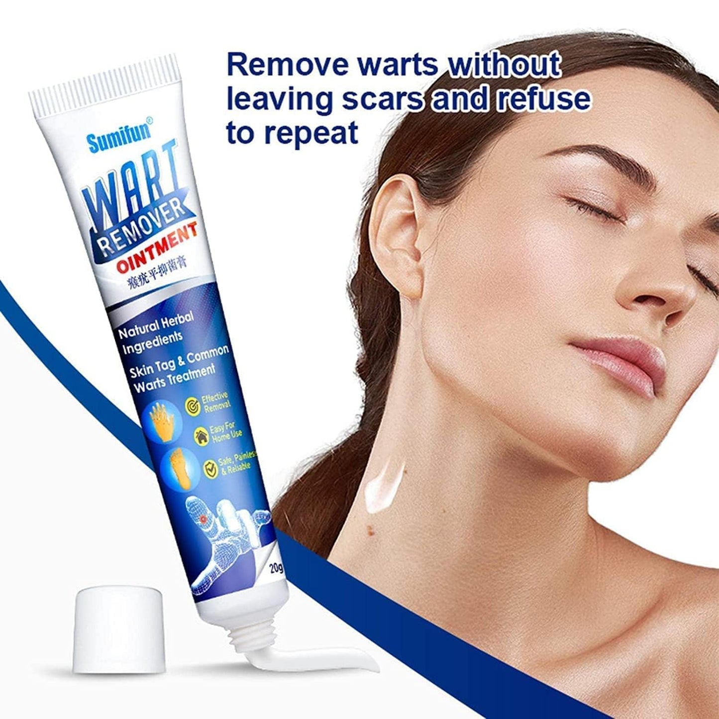 Wart Remover Instant Blemish Removal Cream pack of 2