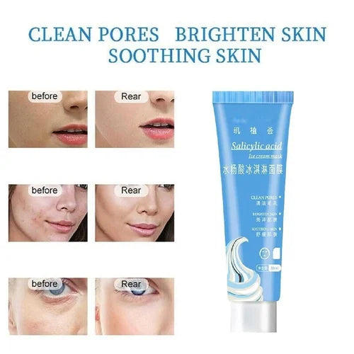Cricia Original Ice Cream Mask For Skin Whitening And Pimple Free Face & Body