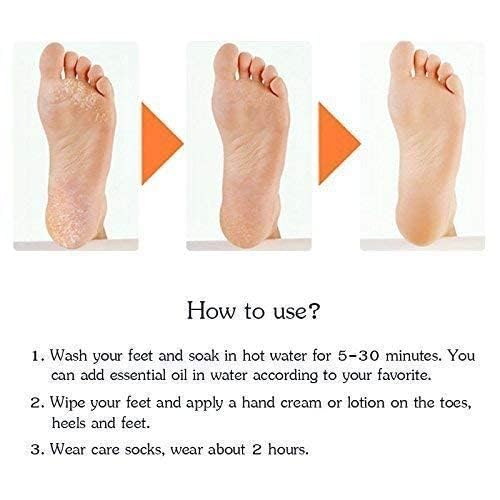 Sovely Anti Crack Silicone Gel Foot Protector Moisturizing Socks for Foot-Care and Heel Cracks Socks for Cracked Feet Heel Pad For Feet, Silicon Heel Pad For Women Pain Relief, Crack Heel Repair Socks Full Length Silicone Gel Foot Protector 1 Pair