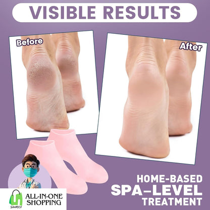 Sovely Anti Crack Silicone Gel Foot Protector Moisturizing Socks for Foot-Care and Heel Cracks Socks for Cracked Feet Heel Pad For Feet, Silicon Heel Pad For Women Pain Relief, Crack Heel Repair Socks Full Length Silicone Gel Foot Protector 1 Pair