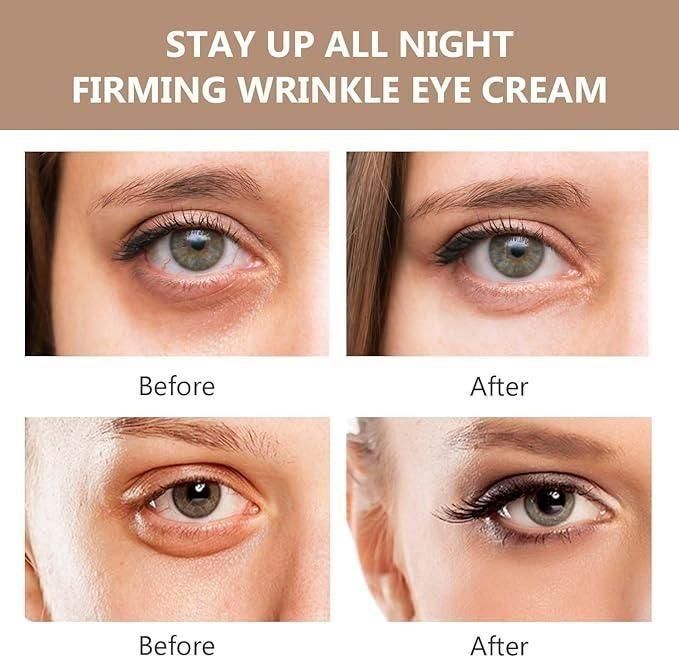Celyz Firmx Eye Tightener (Buy 1 Get 1 Free)