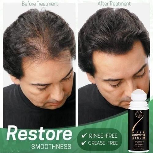 Hair Growth Serum 45ml (Multiple Packs)