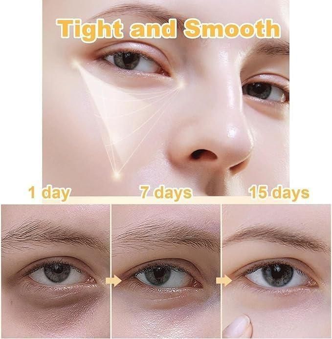 Celyz Firmx Eye Tightener (Buy 1 Get 1 Free)