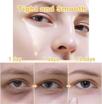 Celyz Firmx Eye Tightener (Buy 1 Get 1 Free)
